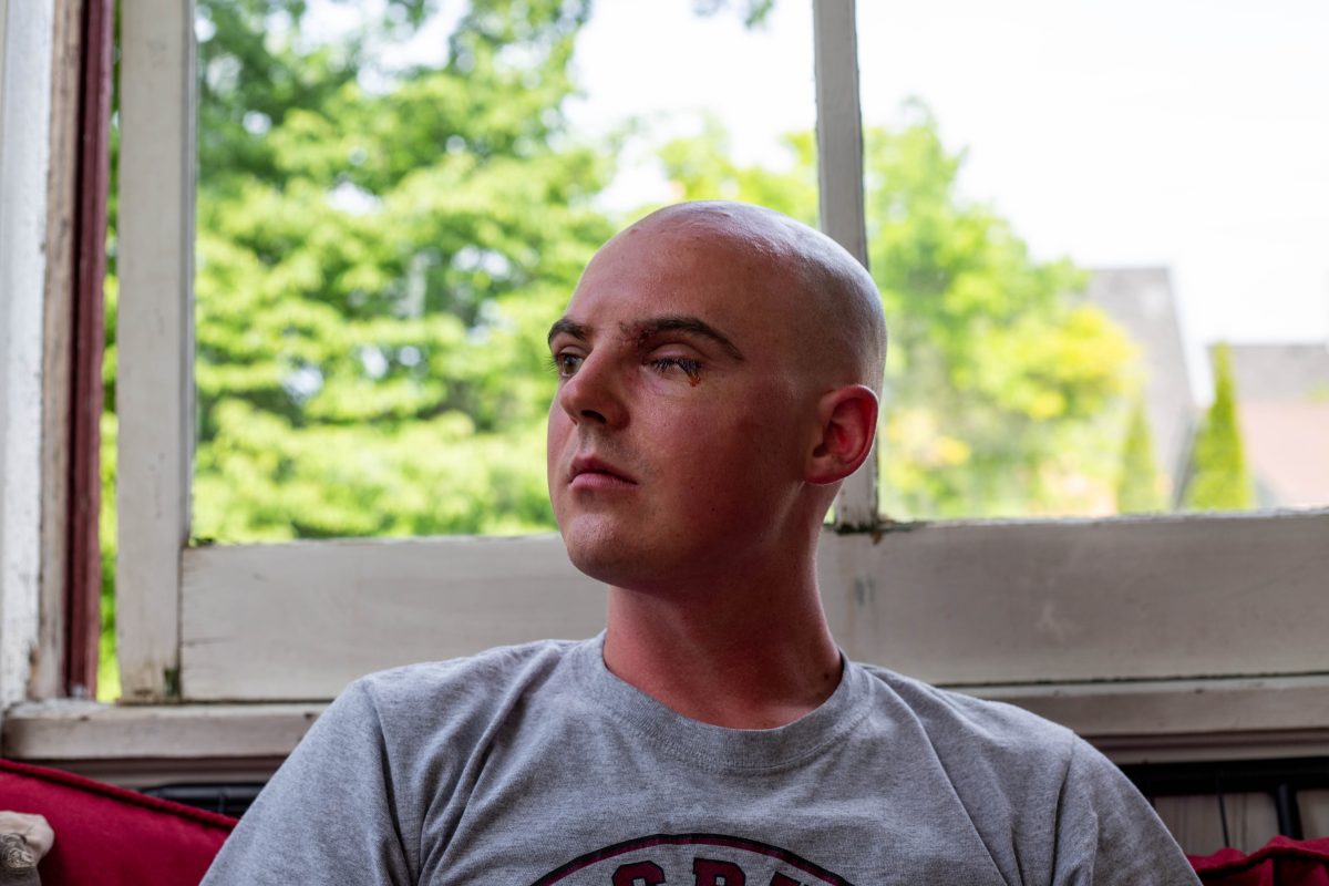 Soren Stevenson sits in the upstairs porch of his Minneapolis home. His eye still bleeding from the impact of the rubber bullet that struck him on May 31 | Photo by Will Jacott. 